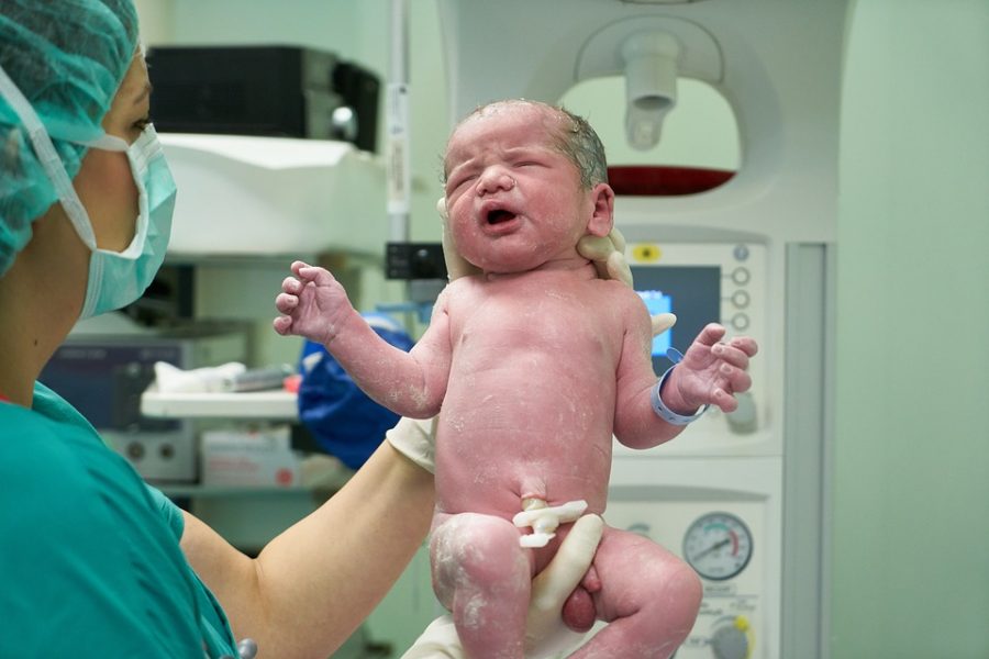 Small Birth Baby Born Hospital Operating Room Yen